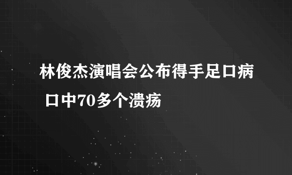 林俊杰演唱会公布得手足口病 口中70多个溃疡