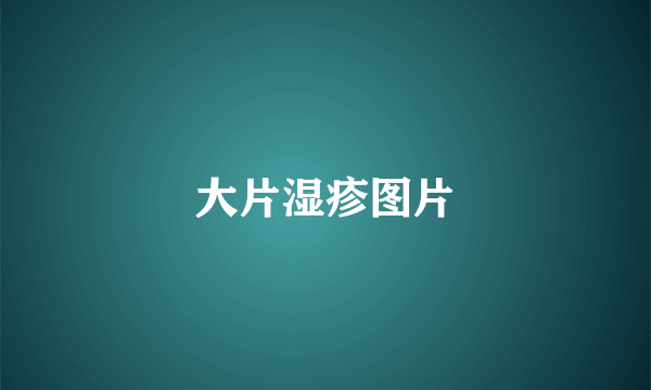 大片湿疹图片