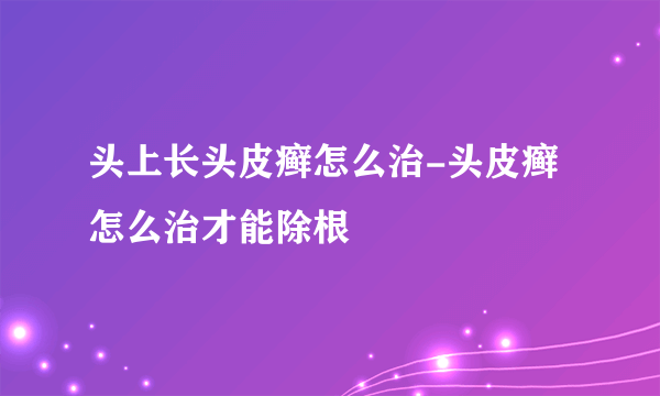 头上长头皮癣怎么治-头皮癣怎么治才能除根