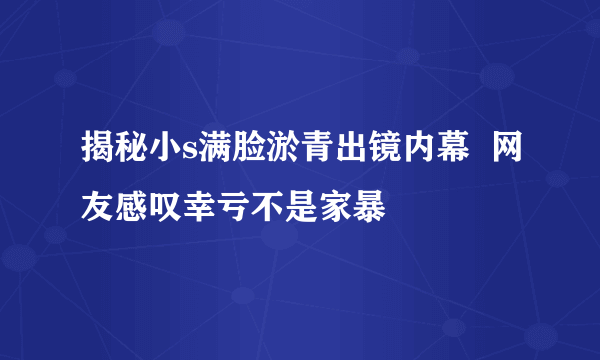 揭秘小s满脸淤青出镜内幕  网友感叹幸亏不是家暴