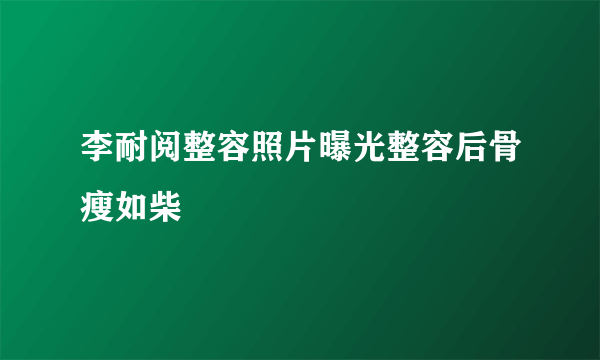 李耐阅整容照片曝光整容后骨瘦如柴