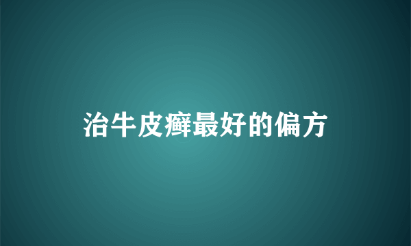 治牛皮癣最好的偏方