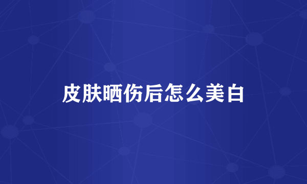 皮肤晒伤后怎么美白
