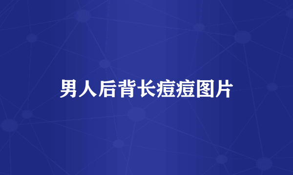 男人后背长痘痘图片