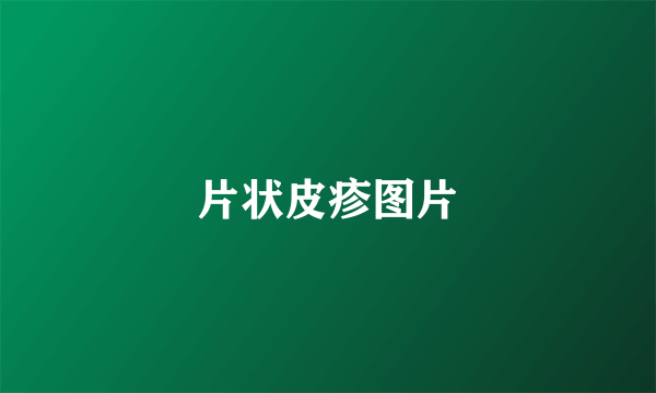 片状皮疹图片