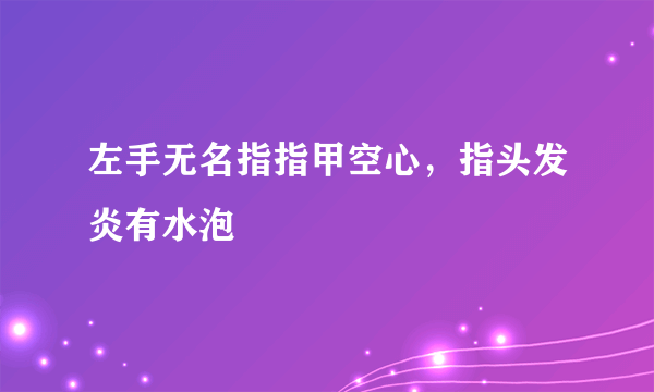 左手无名指指甲空心，指头发炎有水泡