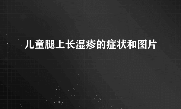 儿童腿上长湿疹的症状和图片