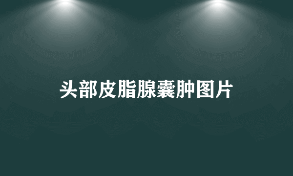头部皮脂腺囊肿图片