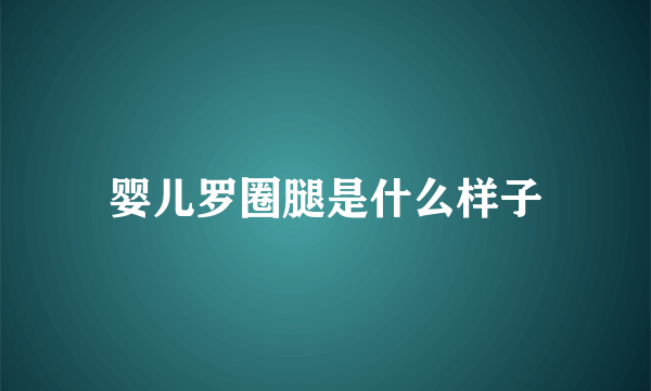 婴儿罗圈腿是什么样子