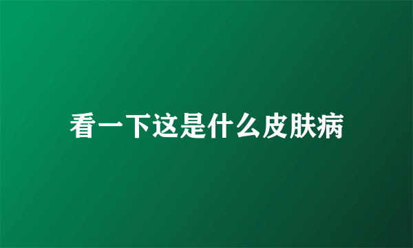 看一下这是什么皮肤病