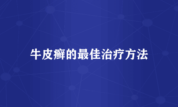 牛皮癣的最佳治疗方法