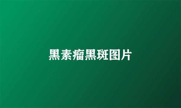 黑素瘤黑斑图片
