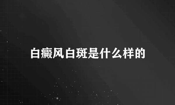 白癜风白斑是什么样的