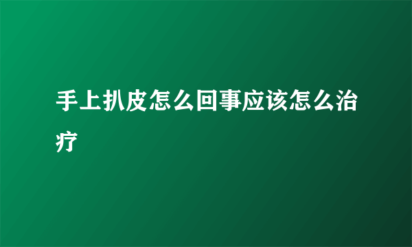 手上扒皮怎么回事应该怎么治疗