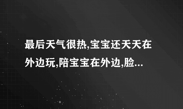 最后天气很热,宝宝还天天在外边玩,陪宝宝在外边,脸两侧...