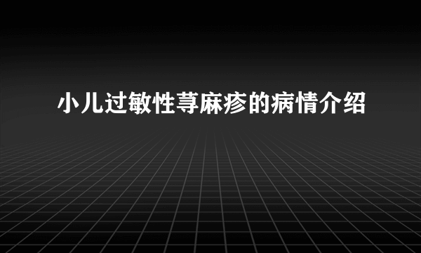 小儿过敏性荨麻疹的病情介绍