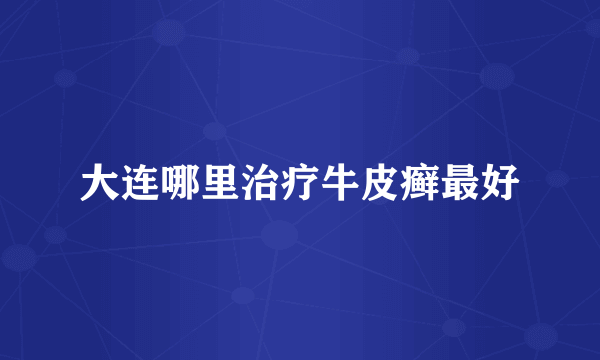 大连哪里治疗牛皮癣最好