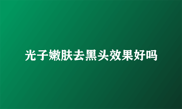 光子嫩肤去黑头效果好吗