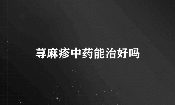 荨麻疹中药能治好吗
