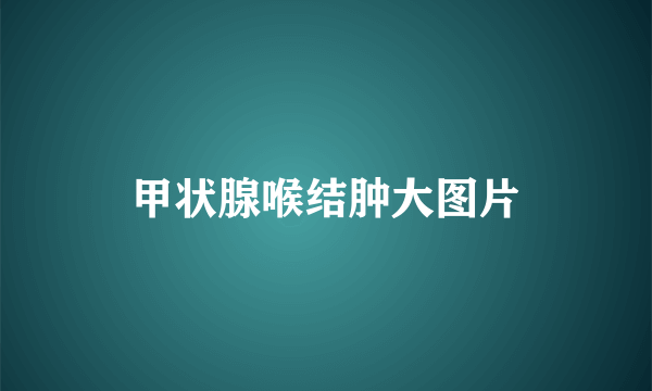 甲状腺喉结肿大图片