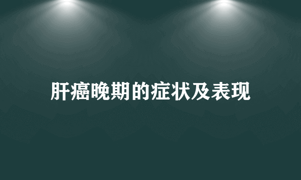 肝癌晚期的症状及表现