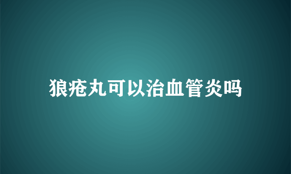 狼疮丸可以治血管炎吗