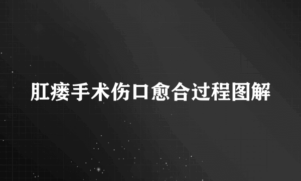 肛瘘手术伤口愈合过程图解