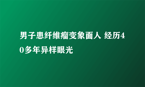 男子患纤维瘤变象面人 经历40多年异样眼光