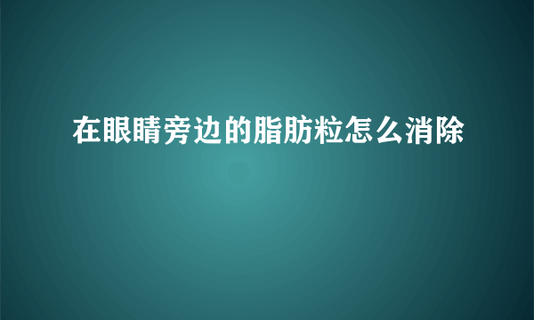 在眼睛旁边的脂肪粒怎么消除