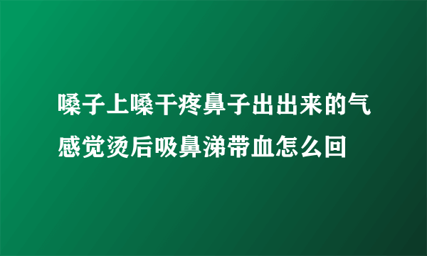 嗓子上嗓干疼鼻子出出来的气感觉烫后吸鼻涕带血怎么回