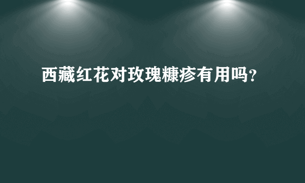 西藏红花对玫瑰糠疹有用吗？