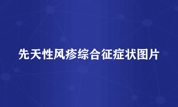先天性风疹综合征症状图片