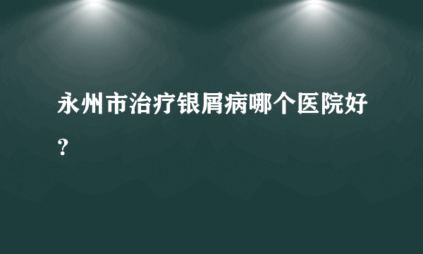 永州市治疗银屑病哪个医院好？