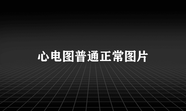 心电图普通正常图片