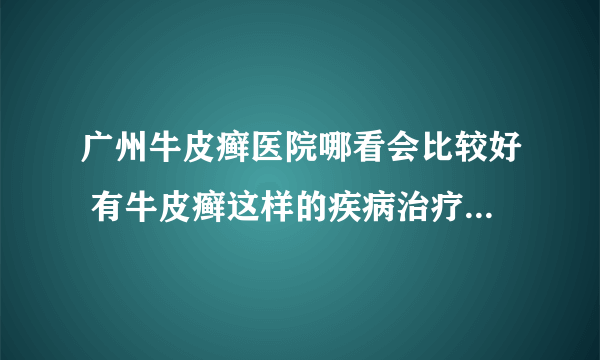 广州牛皮癣医院哪看会比较好 有牛皮癣这样的疾病治疗方法有什么呢