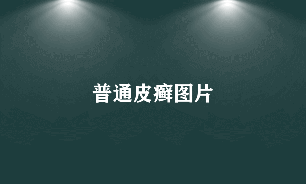 普通皮癣图片