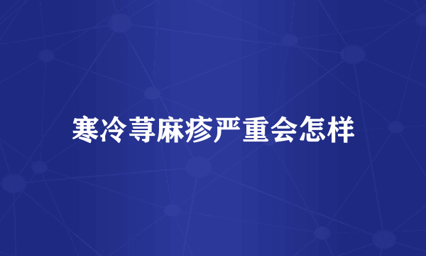 寒冷荨麻疹严重会怎样
