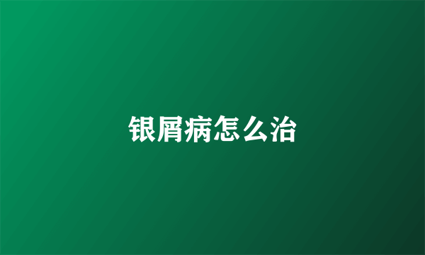 银屑病怎么治