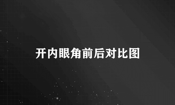 开内眼角前后对比图