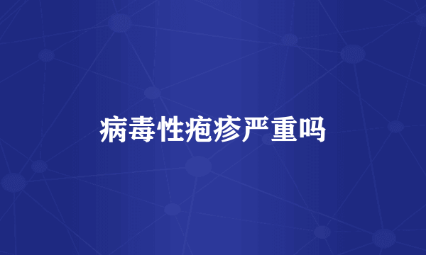 病毒性疱疹严重吗