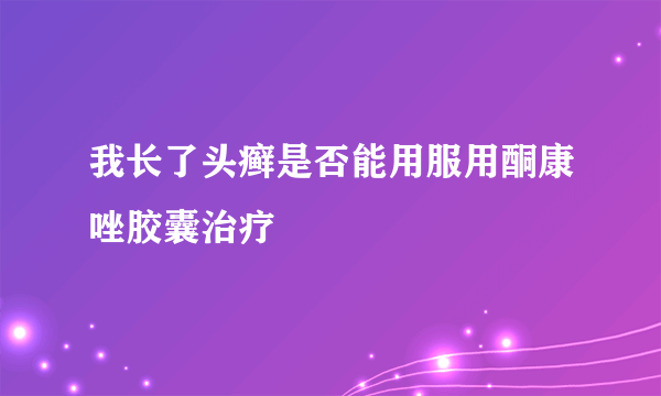 我长了头癣是否能用服用酮康唑胶囊治疗