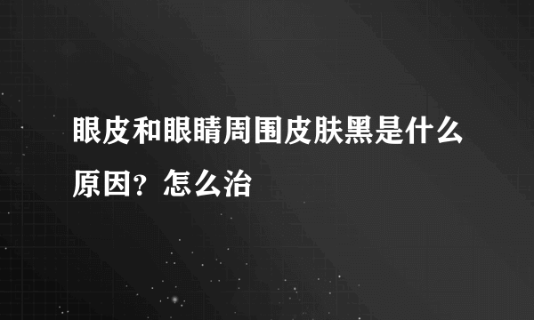 眼皮和眼睛周围皮肤黑是什么原因？怎么治