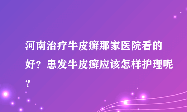 河南治疗牛皮癣那家医院看的好？患发牛皮癣应该怎样护理呢？