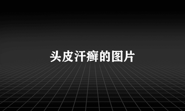 头皮汗癣的图片