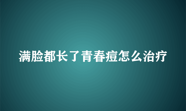 满脸都长了青春痘怎么治疗