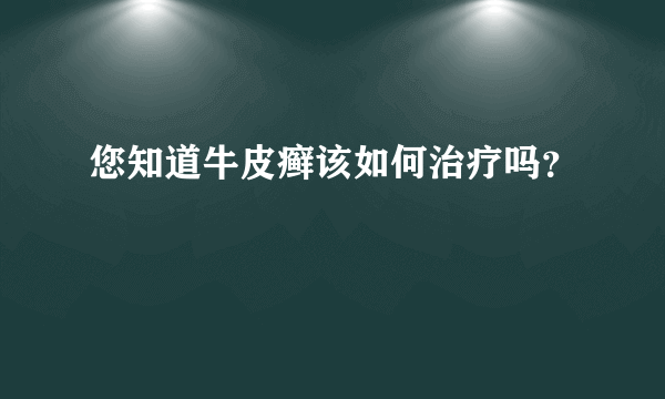 您知道牛皮癣该如何治疗吗？