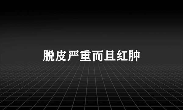 脱皮严重而且红肿
